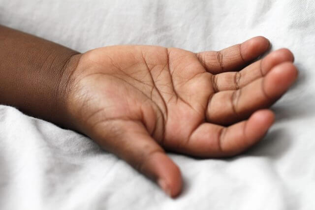 Race Gap Seen in Us Infant Deaths After Fertility Treatment